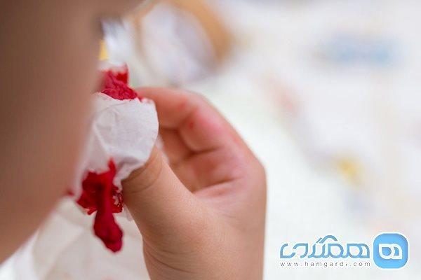 یاری های اولیه به هنگام خون دماغ شدن در سفر