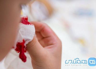 یاری های اولیه به هنگام خون دماغ شدن در سفر